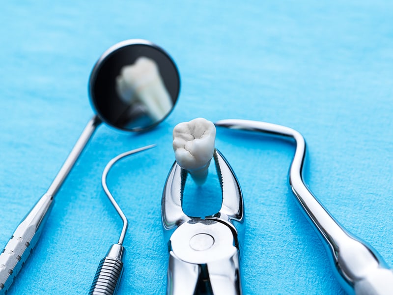 Wisdom Teeth Removal 101: What to Know, When to Get, Signs, and Symptoms